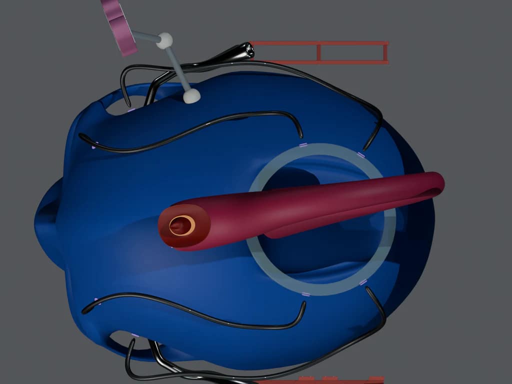 IID 4868 — Top detail